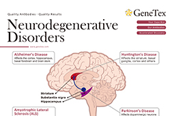 Neurodegenerative Disorders